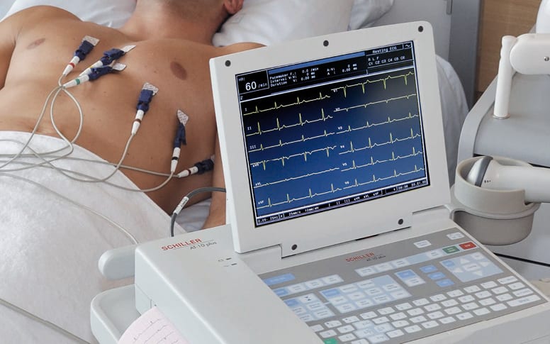 ECG